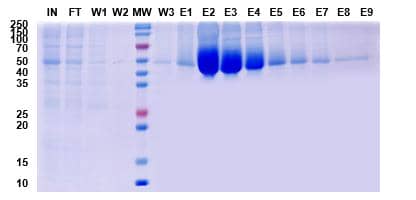 哺乳動(dòng)物細(xì)胞蛋白表達(dá)純化服務(wù)案例