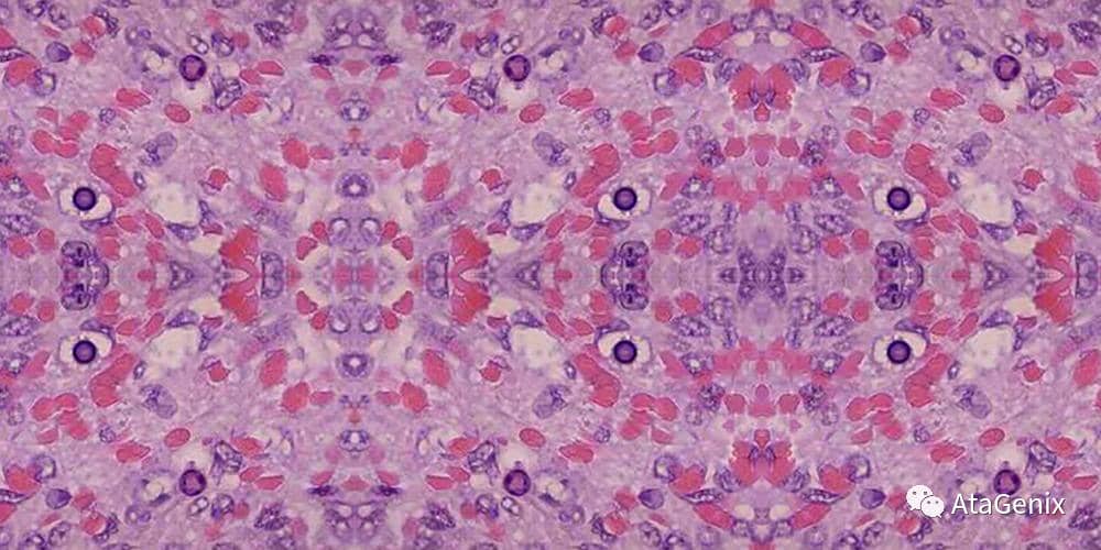 蛋白形成包涵體問題匯總