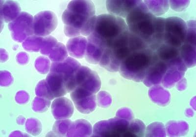 穩(wěn)定細(xì)胞株的構(gòu)建方法及其構(gòu)建注意要點