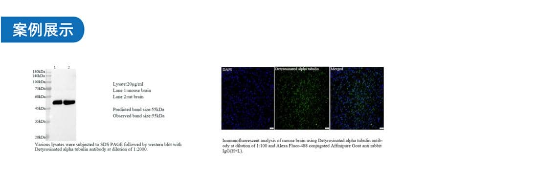 雜交瘤細胞開發(fā)-鼠單克隆抗體僅需59天