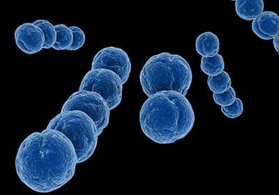 真核細胞蛋白表達