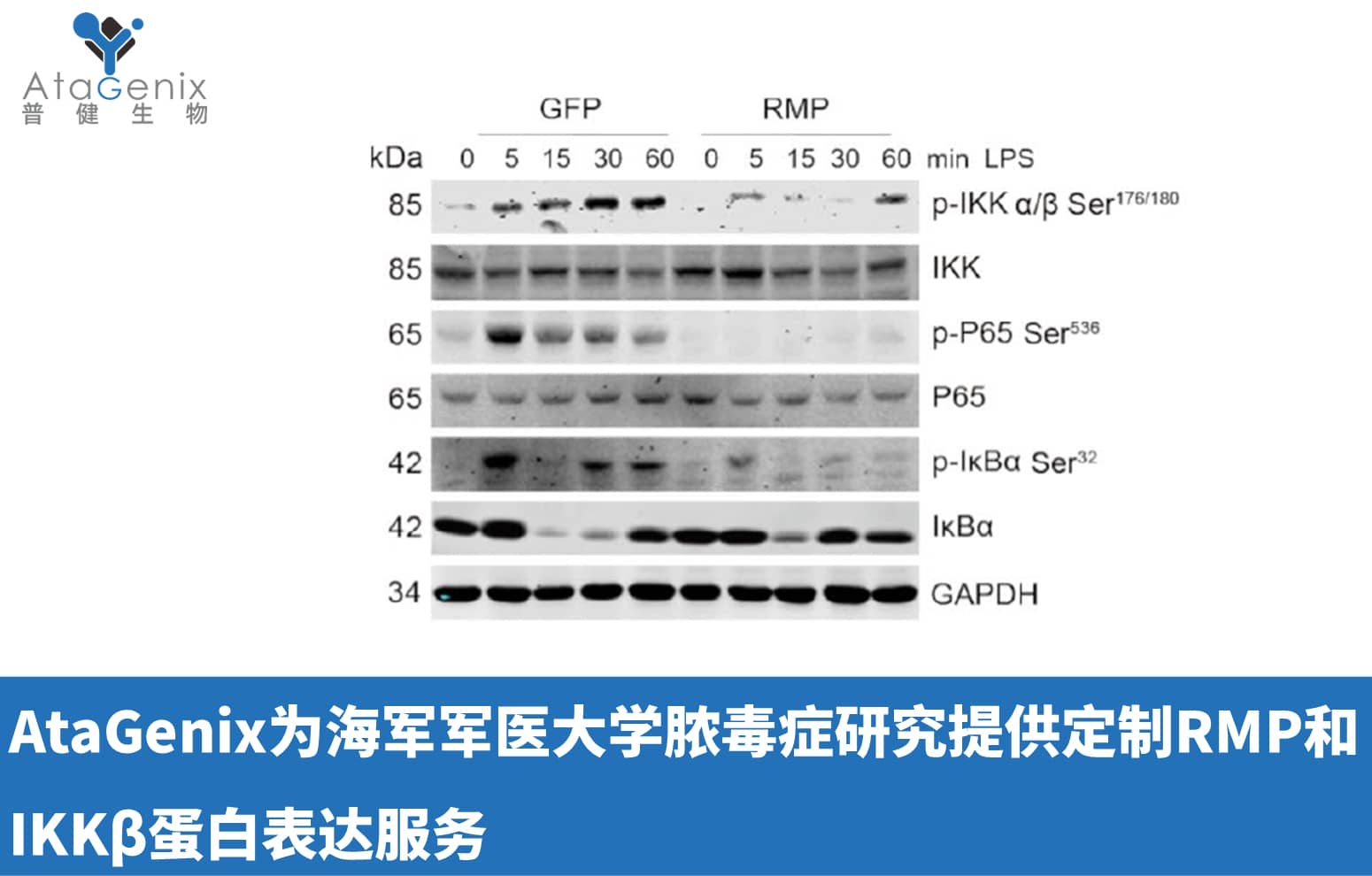 AtaGenix為海軍軍醫大學膿毒癥研究提供定制RMP和IKK&beta;蛋白表達服務